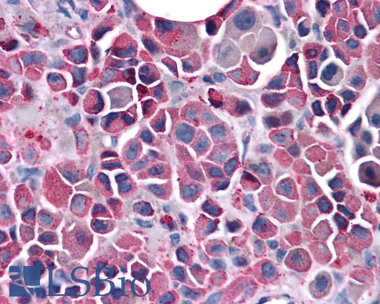 PathPlus™ Polyclonal Rabbit anti-Human FZD3 / Frizzled 3 Antibody (N-Terminus, IHC)