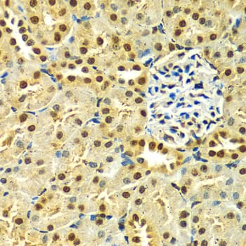 HNRNPA2B1 Antibody