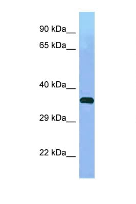 WDR41 Antibody (aa200-249)