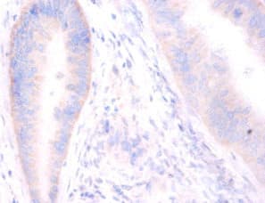 STX6 / Syntaxin 6 Antibody