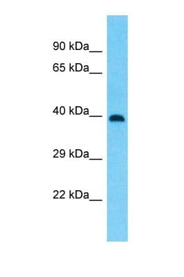 Polyclonal Rabbit anti-Human ZNF586 Antibody (aa231-280, WB)
