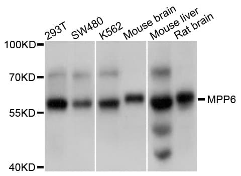 Polyclonal Rabbit anti-Human PALS2 / MPP6 Antibody (WB)