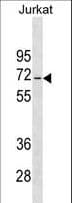 JRKL Antibody (aa412-439)