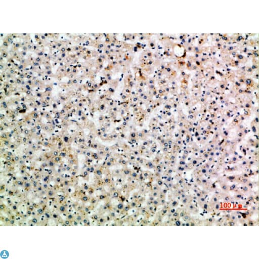 CLEC4M / L-SIGN / CD299 Antibody