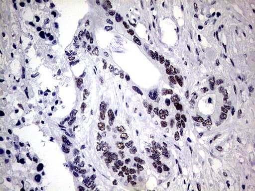ZNF34 Antibody (aa117-405, clone OTI3G2, Carrier-free)