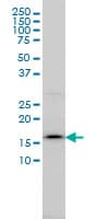 SSR4 Antibody (clone 2D3)