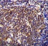Polyclonal Rabbit anti-Human HOXB6 Antibody (aa128-155, IHC, WB)