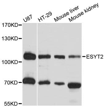 ESYT2 / E-Syt2 Antibody
