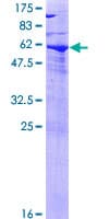 Human SPG21 / MAST Protein (Recombinant GST)