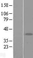 ART4 Protein (Over-Expression Lysate Myc-DDK (Flag))