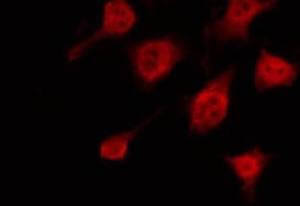 KRT10 / CK10 / Cytokeratin 10 Antibody