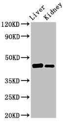 GALT Antibody