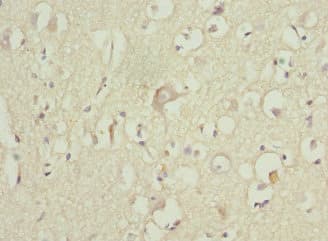 Polyclonal Rabbit anti-Human ZNF148 / ZBP-89 Antibody (IHC, WB)