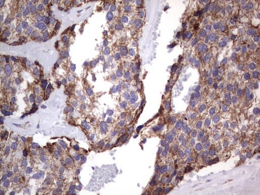 MRPS7 Antibody (aa38-242, clone UMAB156, Carrier-free)