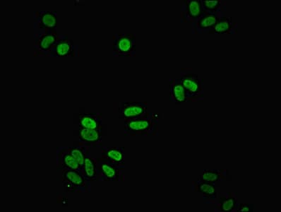 Polyclonal Rabbit anti-Human NDUFS3 Antibody (IHC, IF, WB)