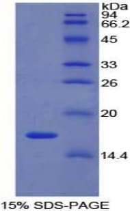 Rat LYAR Protein (Recombinant His-T7)