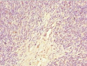 GABRR1 / GABA(A) Receptor rho- Antibody