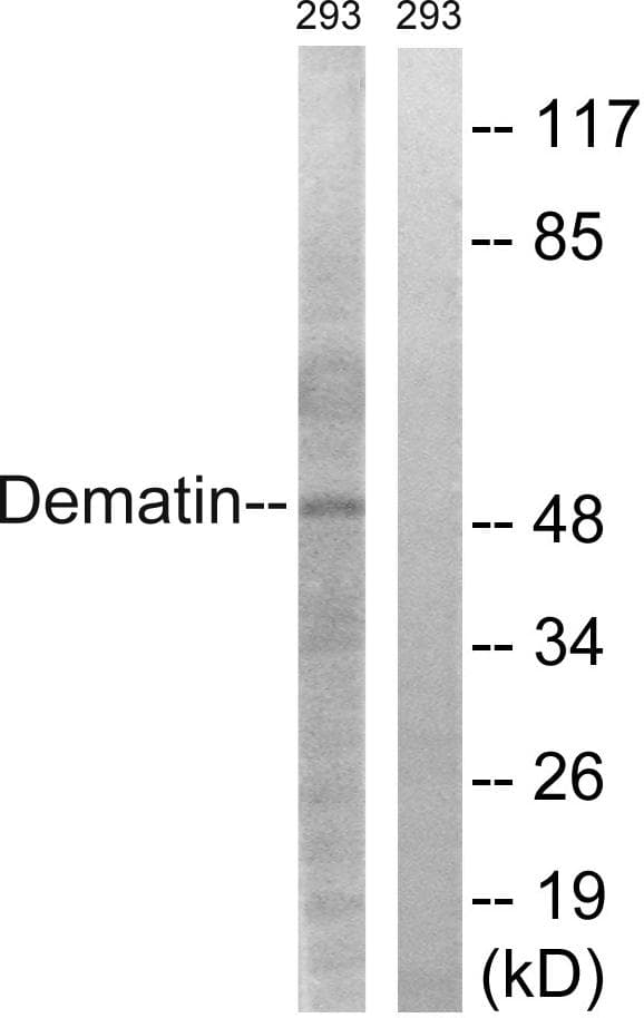 Polyclonal Rabbit anti-Human DMTN / Dematin Antibody (p403, IHC, IF, WB)