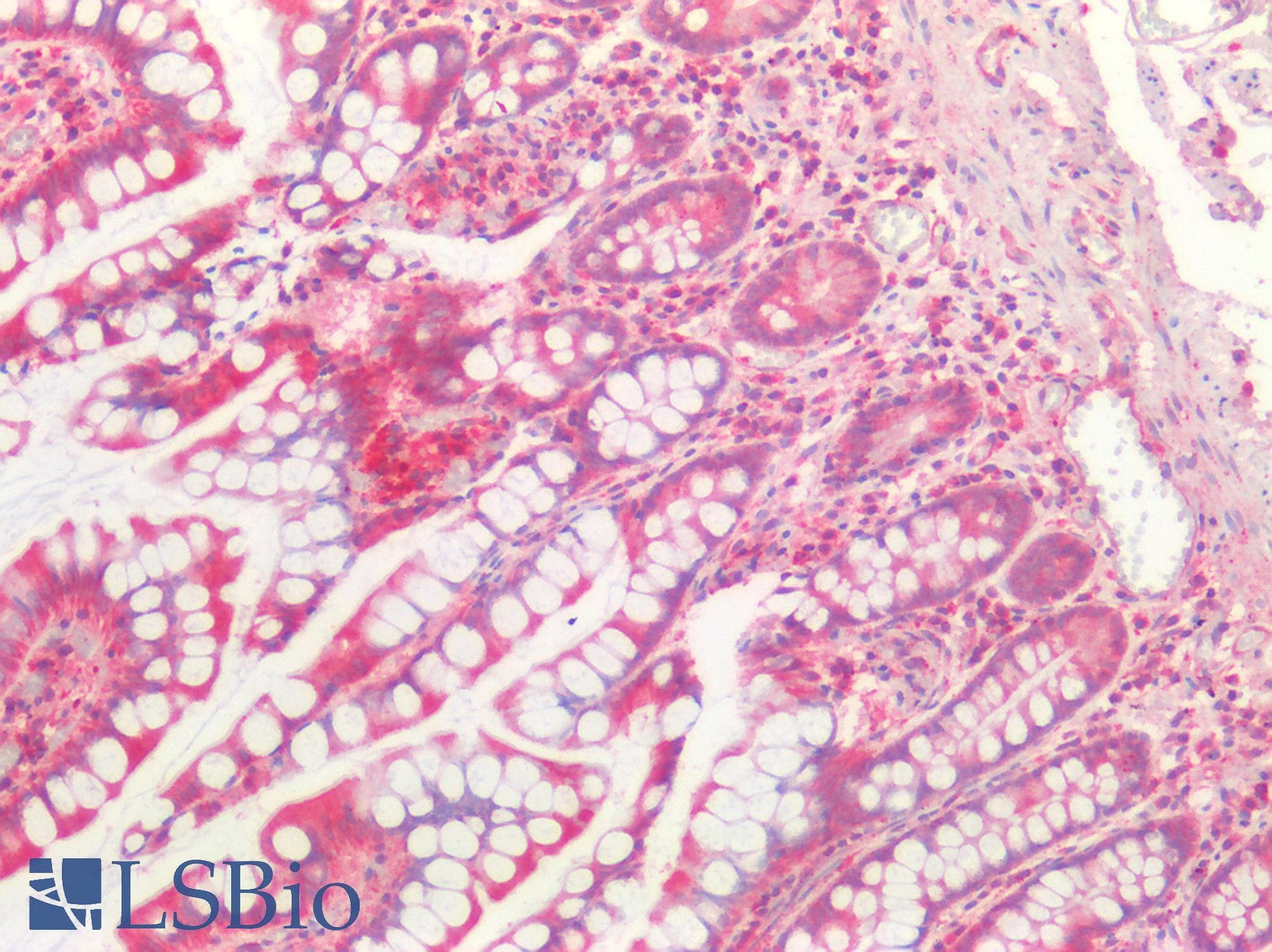 PathPlus™ Polyclonal Goat anti-Human CTSB / Cathepsin B Antibody (Internal Region, IHC, IF, WB)