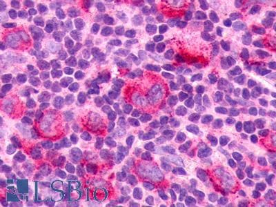 PathPlus™ Polyclonal Rabbit anti-Human CX3CR1 Antibody (Extracellular Domain, IHC)