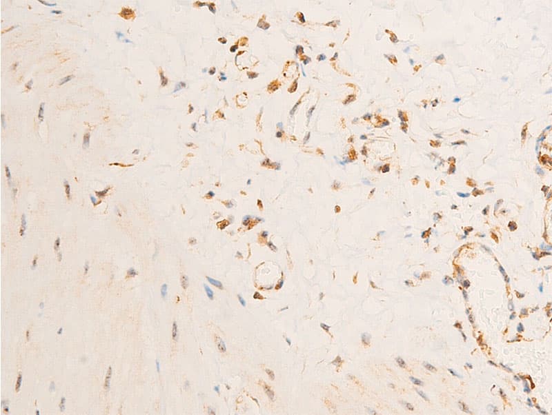 PDPK1 / PDK1 Antibody (phospho-Ser241)
