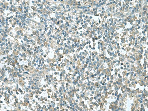 CCT5 / TCP1 Epsilon Antibody