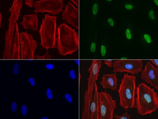 Monoclonal Mouse anti-Human NBN / Nibrin Antibody (clone UMAB100, aa183-460, IHC, IF, WB)