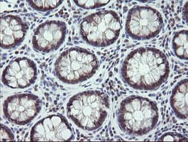 Monoclonal Mouse anti-Human MAP2K3 / MEK3 / MKK3 Antibody (clone OTI1B5, IHC, IF, WB)