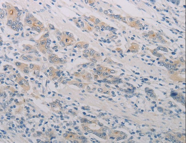 Polyclonal Rabbit anti-Human PTAFR / PAF Receptor Antibody (IHC)