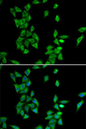 ANXA4 / Annexin IV Antibody