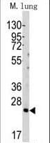 BID Antibody (aa68-103)
