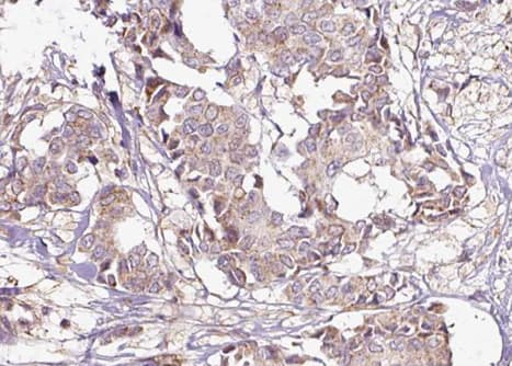 YWHAZ / 14-3-3 Zeta Antibody (phospho-Ser58)