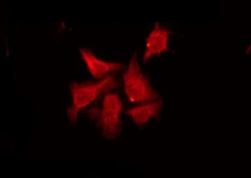 RASD2 Antibody