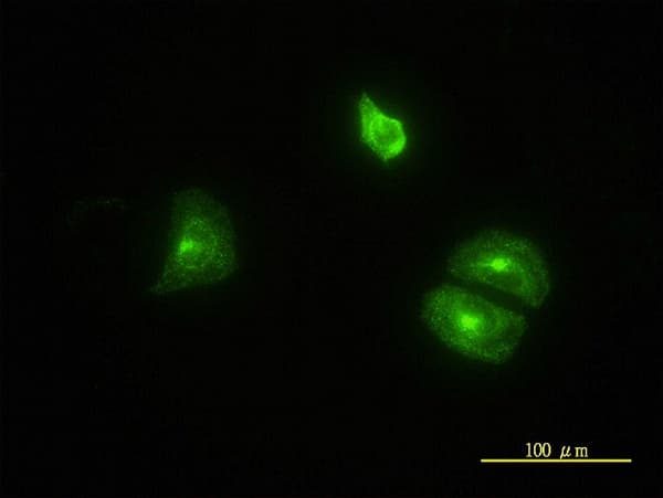 Monoclonal Mouse anti-Human CLTB Antibody (clone 4B12-1E3, IHC, IF, WB)