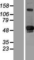 SIVA1 / SIVA Protein (Over-Expression Lysate Myc-DDK (Flag))