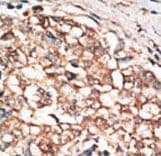 ALK-6 / BMPR1B Antibody (aa472-502)