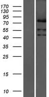 LPPR3 Protein (Over-Expression Lysate Myc-DDK (Flag))