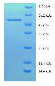 Human CBS Protein (Recombinant His-SUMO)