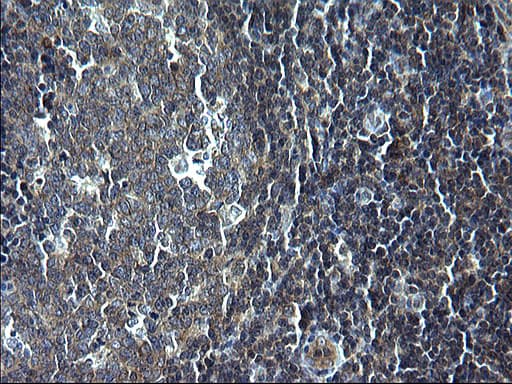 KITLG / SCF Antibody (clone OTI5F6)