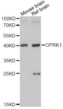 OPRK1 / Kappa Opioid Receptor Antibody