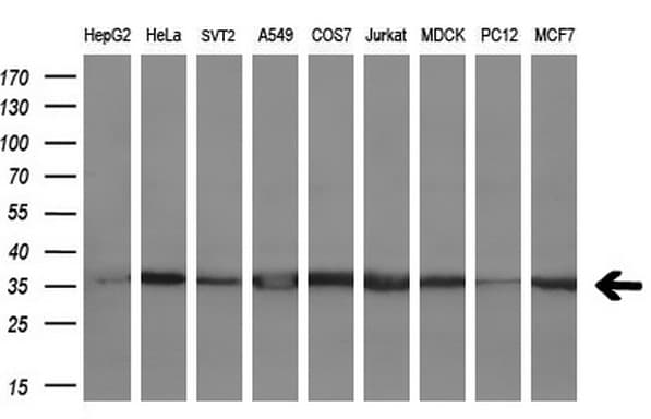 Monoclonal Mouse anti-Human CD80 Antibody (clone OTI3F1, IHC, WB)