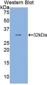 TUBB / Beta Tubulin Antibody (FITC)