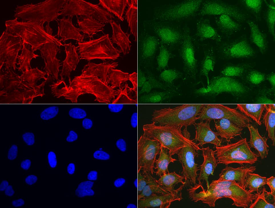 BBOX1 / BBOX Antibody (clone UMAB120)
