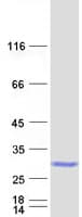 Human RAB35 Protein (Recombinant Myc-DDK (Flag))