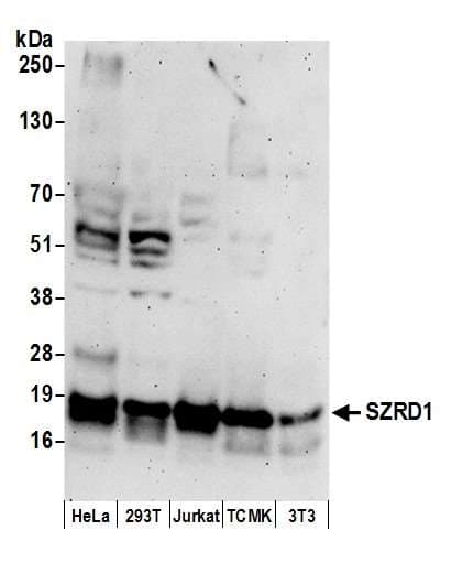 SZRD1 / C1orf144 Antibody (aa102-152)