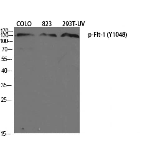 Polyclonal Rabbit anti-Human FLT1 / VEGFR1 Antibody (980-1060 aa, IHC, WB)