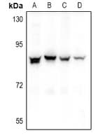 Polyclonal Rabbit anti-Human NOL10 Antibody (IHC, WB)