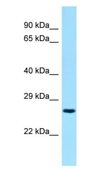 Polyclonal Rabbit anti-Human BIN3 Antibody (C-Terminus, WB)