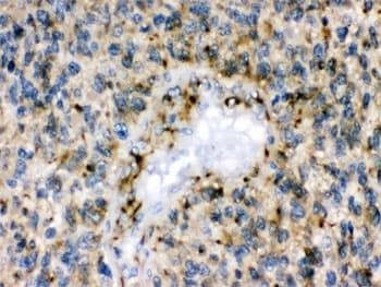 Polyclonal Rabbit anti-Human EPHB1 / EPH Receptor B1 Antibody (IHC, WB)