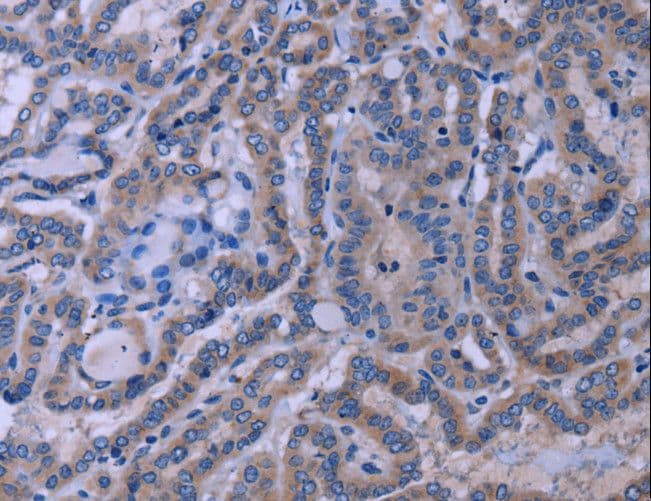 TUBGCP2 / GCP2 Antibody